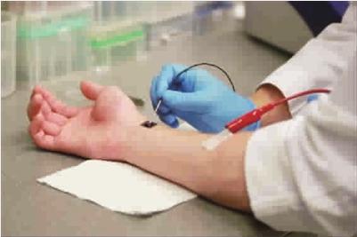 納米皮膚芯片 修復整個器官 納米皮膚芯片 修復整個器官