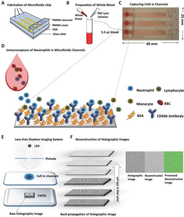 監(jiān)控血液中嗜中性粒細(xì)胞數(shù)量的新方法 監(jiān)控血液中嗜中性粒細(xì)胞數(shù)量的新方法