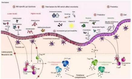 腸道菌群在多發(fā)性硬化中的作用 腸道菌群在多發(fā)性硬化中的作用