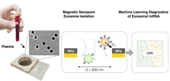 納米流控技術(shù)與機(jī)器學(xué)習(xí)相結(jié)合利用外泌體精確診斷胰腺癌 納米流控技術(shù)與機(jī)器學(xué)習(xí)相結(jié)合利用外泌體精確診斷胰腺癌