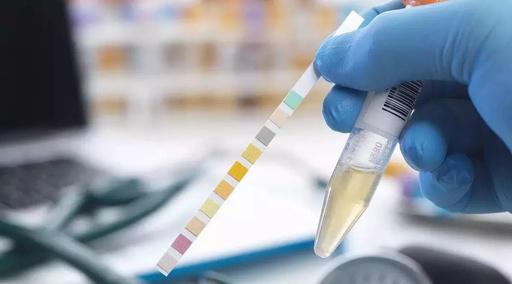 現場快速檢測 現場快速檢測