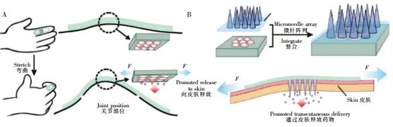 圖2可穿戴式微流控藥物釋放裝置。(A)內置藥物的可穿戴式微流控芯片,通過手指的彎曲完成藥物釋放(B)內置藥物的可穿戴芯片與微針陣列結合 圖2可穿戴式微流控藥物釋放裝置。(A)內置藥物的可穿戴式微流控芯片,通過手指的彎曲完成藥物釋放(B)內置藥物的可穿戴芯片與微針陣列結合