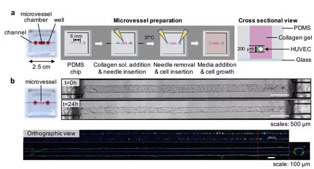 利用芯片制備體外人微血管。圖片來源:EBioMedicine 利用芯片制備體外人微血管。圖片來源:EBioMedicine