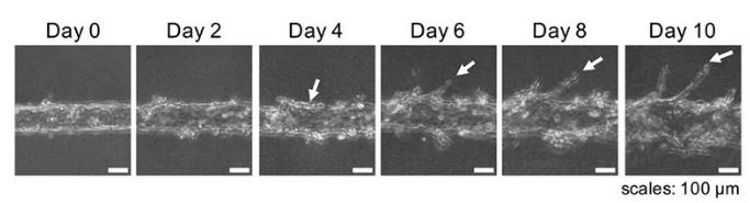 隨著時間的推移,可以用顯微鏡觀察到血管的新生。圖片來源:EBioMedicine 隨著時間的推移,可以用顯微鏡觀察到血管的新生。圖片來源:EBioMedicine