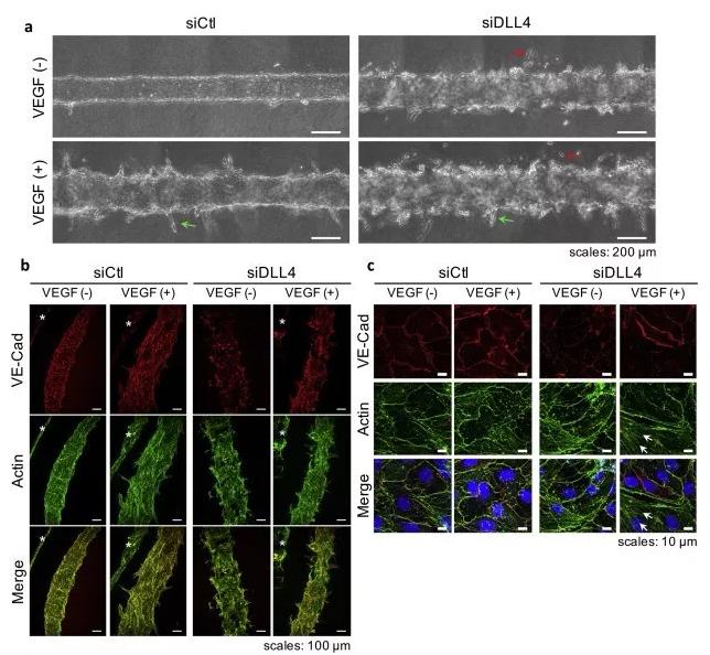 敲除DLL4將影響血管的新生和穩定性。圖片來源:EBioMedicine 敲除DLL4將影響血管的新生和穩定性。圖片來源:EBioMedicine