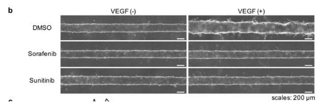 向芯片中添加抗腫瘤藥物sorafenib或sunitinib,觀察到了血管新生的抑制現象。 圖片來源:EBioMedicine 向芯片中添加抗腫瘤藥物sorafenib或sunitinib,觀察到了血管新生的抑制現象。 圖片來源:EBioMedicine