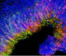 由3D細胞培養產生的新生視網膜 由3D細胞培養產生的新生視網膜