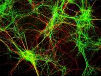 芯片實(shí)驗(yàn)室和細(xì)胞生物學(xué) 芯片實(shí)驗(yàn)室和細(xì)胞生物學(xué)