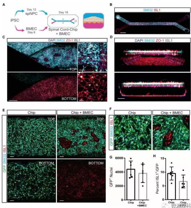 最新器官芯片技術(shù)為“漸凍人”點(diǎn)燃希望 最新器官芯片技術(shù)為“漸凍人”點(diǎn)燃希望
