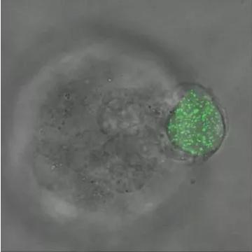 華中科大研發(fā)出測量三維生物力的新技術(shù),有望用于癌癥早期診斷 華中科大研發(fā)出測量三維生物力的新技術(shù),有望用于癌癥早期診斷
