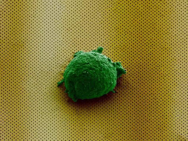 《Small》雜志封面圖片顯示,單個淋巴瘤細胞孤獨地存在于新型生物傳感器上。 《Small》雜志封面圖片顯示,單個淋巴瘤細胞孤獨地存在于新型生物傳感器上。