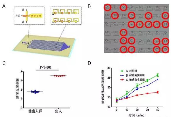 圖3A.液滴微流控芯片原理設計圖結構包含上游的液滴生成區和下游的液滴捕獲區;B.利用液滴熒光成像分辨細菌陽性和陰性液滴;C.液滴數字化分析顯示健康人和尿路感染病人尿液細菌計數差別;D.液滴數字化分析顯示敏感和耐藥細菌對于抗生素的反應。 圖3A.液滴微流控芯片原理設計圖結構包含上游的液滴生成區和下游的液滴捕獲區;B.利用液滴熒光成像分辨細菌陽性和陰性液滴;C.液滴數字化分析顯示健康人和尿路感染病人尿液細菌計數差別;D.液滴數字化分析顯示敏感和耐藥細菌對于抗生素的反應。