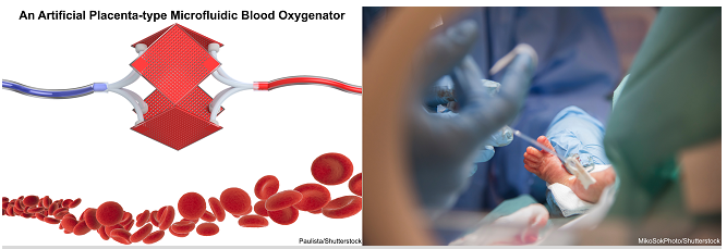 微加工技術解決早產兒肺功能不全的問題不再是夢