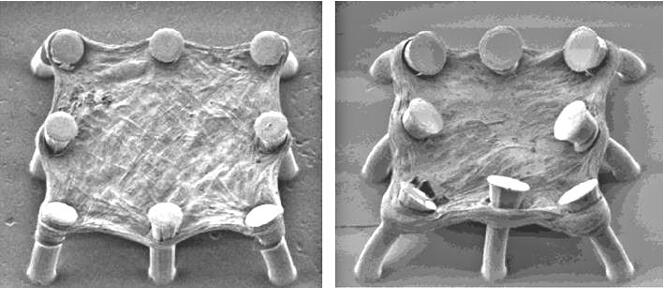 在微柱上培養的肺組織（左）和經過TGF-beta處理后收縮并模擬纖維化的肺組織（右）