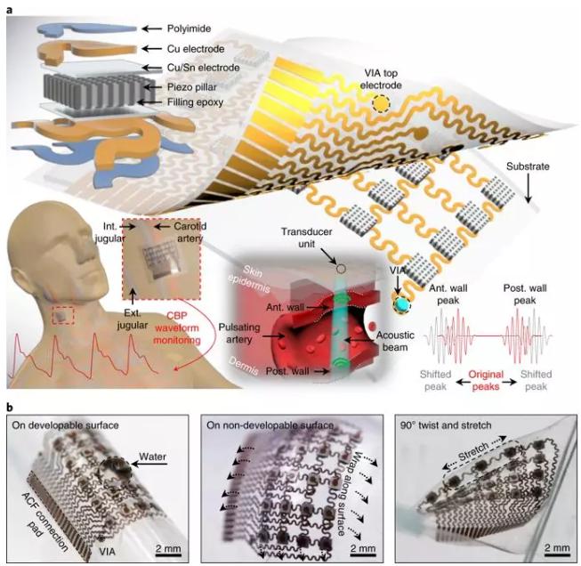 可實時監測體內深處動脈血壓的柔性超聲波貼片 可實時監測體內深處動脈血壓的柔性超聲波貼片