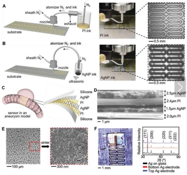 可拉伸的無線傳感器可以監測腦動脈瘤的愈合 可拉伸的無線傳感器可以監測腦動脈瘤的愈合