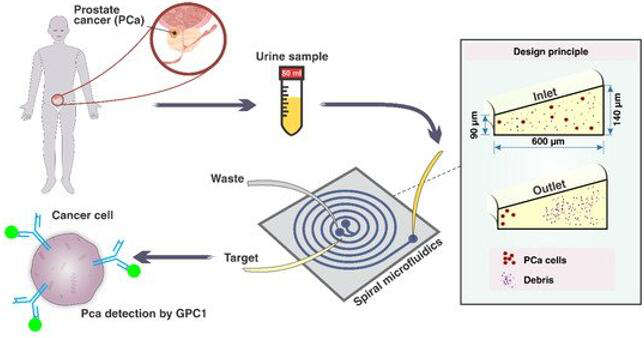 有望無創檢測前列腺癌的微流控芯片